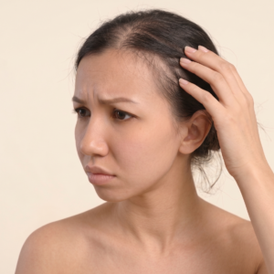 Hair Thinning Solution