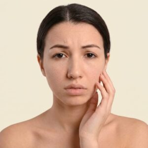 Dry Skin